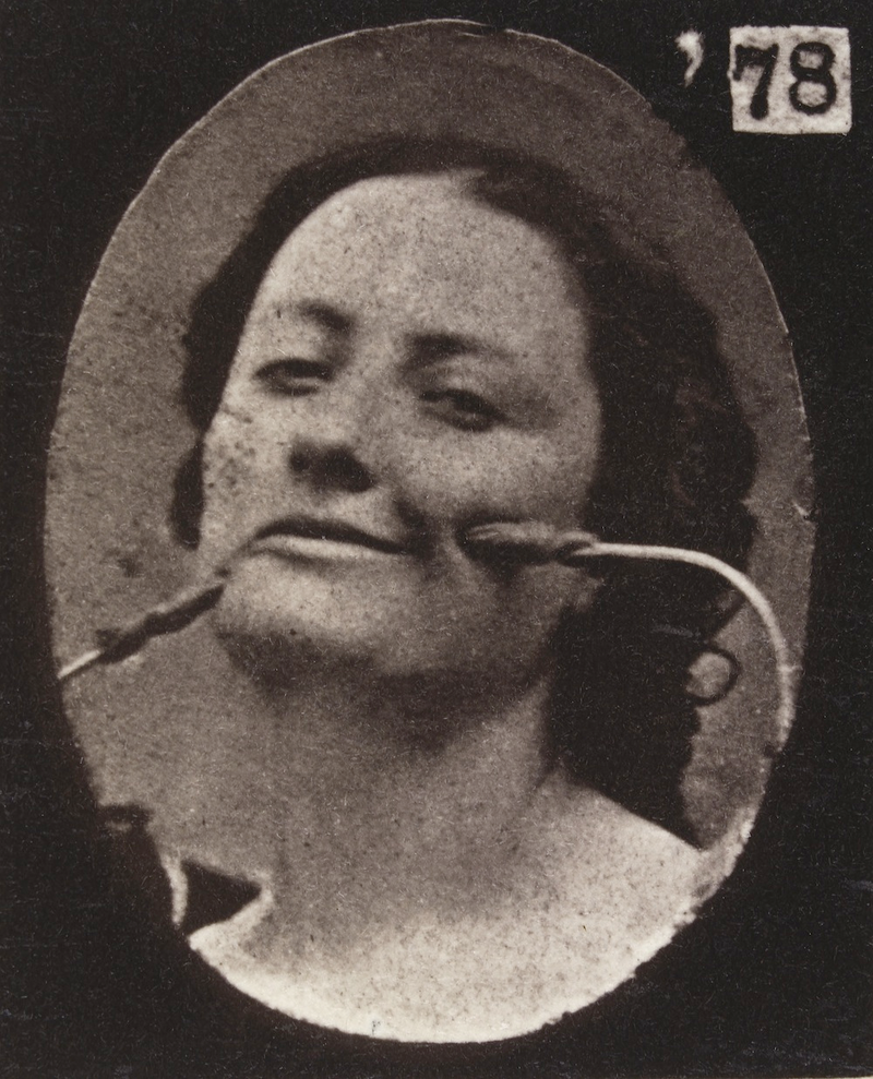 Illustration for article titled Terrifying, Century-Old Photographs from Neuroscience Experiments